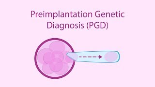 Preimplantation Genetic Diagnosis PGD [upl. by Aliled966]