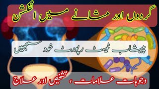 UTI  Urinary tract infection  Hindi Urdu  Causes  Symptoms  Diagnosis  Treatment  Ultrasound [upl. by Venetia314]