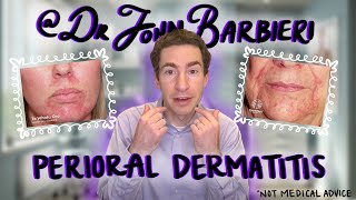 Dermatologist Explains Perioral Dermatitis How to Identify Causes amp Treatment [upl. by Eednus]