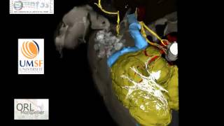 Anatomie 3D plan axial [upl. by Airdnua169]