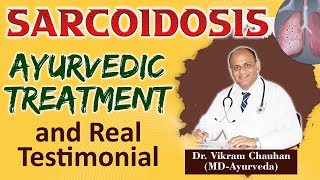 Sarcoidosis Ayurvedic Treatment and Real Testimonial [upl. by Julissa232]