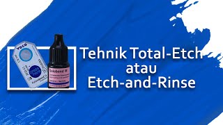 Teknik TotalEtch atau EtchandRinse  Sistem Adhesif Penambalan Resin Komposit Bonding VOCO [upl. by Seyah]