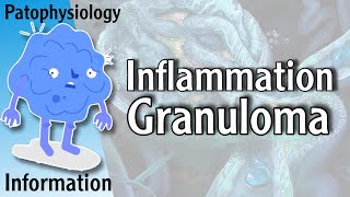 Granuloma  Granulomatous Inflammation شرح [upl. by Ninazan]