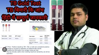 Quantiferon TB Gold test in Hindi  टीबी मरीजों के लिए TB gold टेस्ट क्या है  Result amp Normal value [upl. by Eerased]