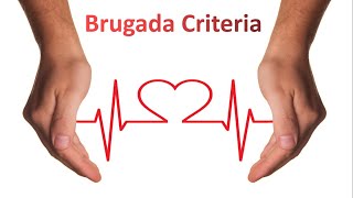 Brugada Criteria for VT vs SVT I ECG Made Super Easy [upl. by Hako]