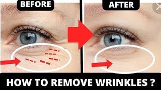 HOW TO GET RID OF CROWS FEET  EYE WRINKLES  FACE YOGA AND MASSAGE [upl. by Fredela]