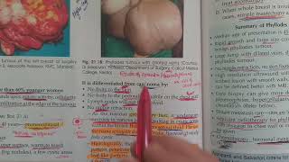 Phyllodes tumor  Cystosarcoma Phyllode in hindi [upl. by Ranson]