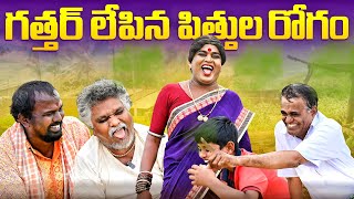 గత్తర్ లేపిన పిత్తుల రోగం  KOMARAKKA TV  VILLAGE COMEDY  GADDAM SURESH  JABARDASTH KOMARAM [upl. by Nidla]