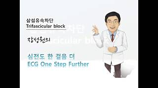 심전도 한 걸음 더 35 삼섬유속 차단 Trifascicular block [upl. by Aer961]