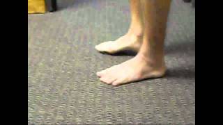 Severe ankle sprain  painfree running and jumping after 4 treatments mp4 [upl. by Ardnayek]