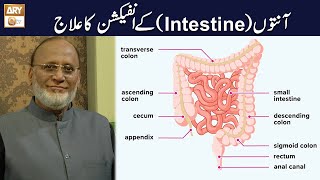 Aanton Intestine main Infection ka Ilaj  Hakeem Syed Abdul Basit [upl. by Lydia]