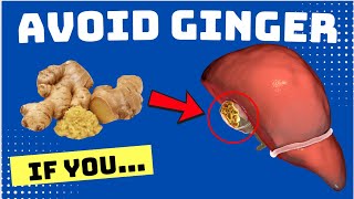 AVOID GINGER if You Have THESE Problems [upl. by Cerracchio]