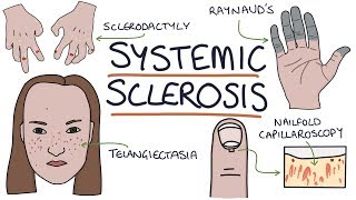 Systemic Sclerosis and Scleroderma Visual Explanation for Students [upl. by Autumn974]