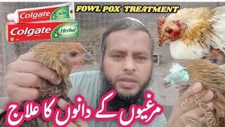 fowl pox treatment with use colgate toothpaste  chicken pox ka aasan alaj [upl. by Kasper76]