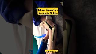 Fast 15 Sec Elbow Dislocation Correction🔥 कोहनी चढ़ाने की प्रक्रिया 🔥 [upl. by Aliemaj]