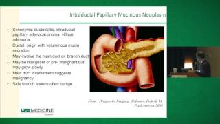 Pancreatic Cysts Diagnosis amp Management [upl. by Gail716]