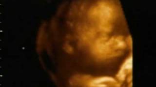 Our baby girl  28 weeks  3d ultrasound [upl. by Altis]