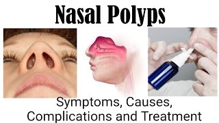 Nasal Polyps  Symptoms Causes Complications and Treatment [upl. by Eiclehc]