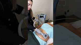 BTL Exilis Elite — Noninvasive Liposuction [upl. by Waylin232]