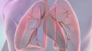 Symptoms of lung cancer [upl. by Dott484]