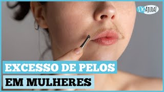 EXCESSO DE PELOS HIRSUTISMO O QUE FAZER [upl. by Lizzie]