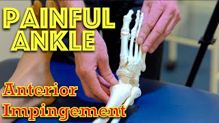 Ankle Pain  Anterior Impingement  Dr Gill [upl. by Halstead]