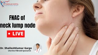 Live FNAC test  How FNAC test is done  FNAC of neck lymph node [upl. by Rollecnahc]