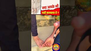 ssc gd leg medical test  पैर की उंगली चोटी  army leg medical test shortsfeed sscgdmedical viral [upl. by Amalberga34]