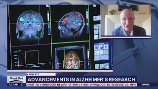 Advancements in Alzheimers research [upl. by Oibesue]