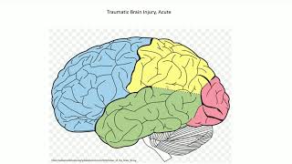 Acute Traumatic Brain Injury  Adventures in Neuropathology [upl. by Arria]