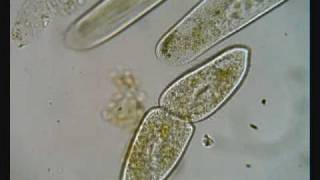 Paramecium Dividing [upl. by Nivac839]