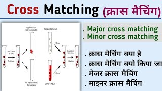 Cross matchingMajor cross matchingminor cross matchingcross matching methodKiran maurya [upl. by Papotto]