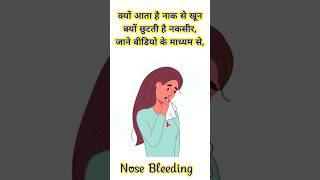 क्यों आता है नाक से खूनNose bleeding health nosebleed nosebleeding shorts youtubeshorts [upl. by Tacklind517]