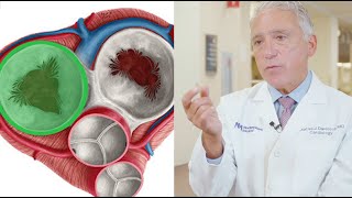 Advances in Transcatheter Tricuspid Valve Repair amp Replacement with Dr Charles Davidson [upl. by Marline]