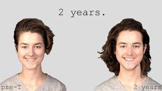 ftm 2 years on testosterone [upl. by Merilyn]