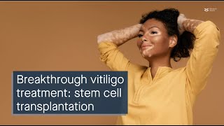 Breakthrough vitiligo treatment hair follicle melanocyte stem cell transplantation [upl. by Ahsilaf460]