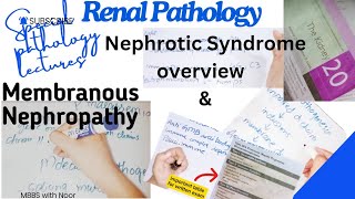 membranous nephropathy  nephrotic syndrome  renal pathology lectures  selflessmedicose [upl. by Rigby]