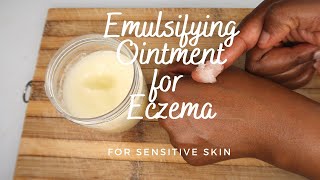 Homemade Eczema Ointment [upl. by Nodnarbal]