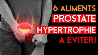 6 Aliments À ÉVITER pour une PROSTATE HYPERTROPHIÉ [upl. by Enelear894]