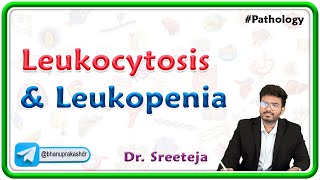 18 Leukocytosis and Leukopenia  USMLE Step 1 Pathology [upl. by Kcirdet562]