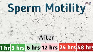 Sperm motility after 1 hour to 48 hours in semen sample  sperm  semen  sperm motility [upl. by Richter]