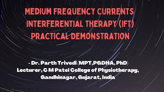 Medium Frequency Current  Interferential Therapy IFT Practical Demonstration [upl. by Ahseek]