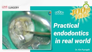 Practical endodontics in real world  Dr Kim Pyungsik [upl. by Nurse330]