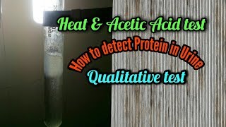 Heat and acetic acid test  how to detect protein in urine for MLT amp Pathology students in english [upl. by Aehtla883]