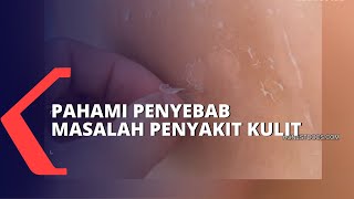 Ketahui Penyebab Penyakit Kulit dan Cara Mengatasinya [upl. by Cicely70]