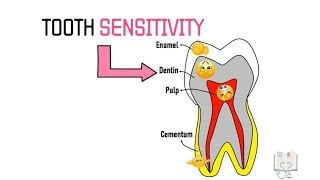 Theories of Dentin Sensitivity Hypersensitivity [upl. by Bonney]