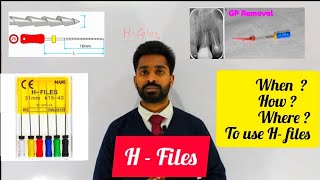 H  Files in Endodontics [upl. by Lleder]