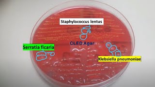 Staphylococcus lentus Klebsiella pneumoniae and Serratia ficaria on CLED Agar of Urine Culture [upl. by Kerri]