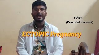 Obsampgyn viva Ectopicpregnancy Part 1 Introduction Site amp pathogenesis [upl. by Htebasil]