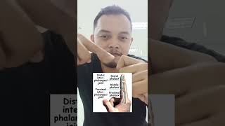 Must Watch Fix Jammed Finger  Sprained Finger Basketball Treatment [upl. by Aderf]